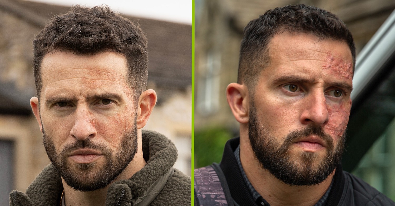 Ross Barton and his time in Emmerdale: Affair with Debbie, acid attack, painkiller addiction and return to the soap