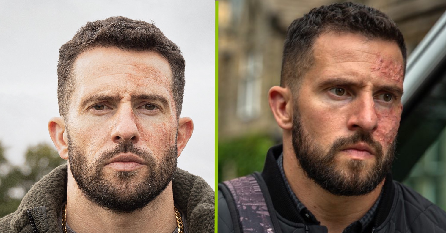 Emmerdale reveals more details as they confirm return of Ross Barton after six years